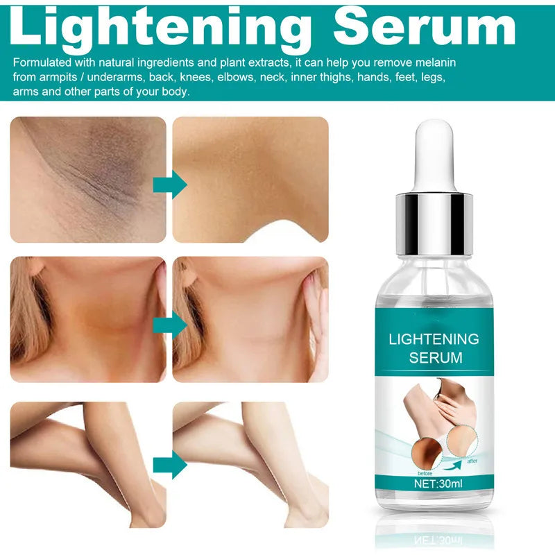 Body Whitening Oil Private Parts Underarm Bleaching Serum Whiten Butt Knee Brighten Inner Thigh Intimate Dark Remove Melanin