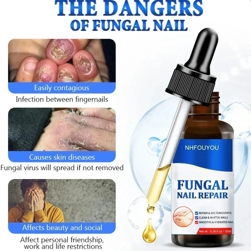 Kerasal Fungal Nail Renewal, Restores Appearance of Discolored or Damaged Nails