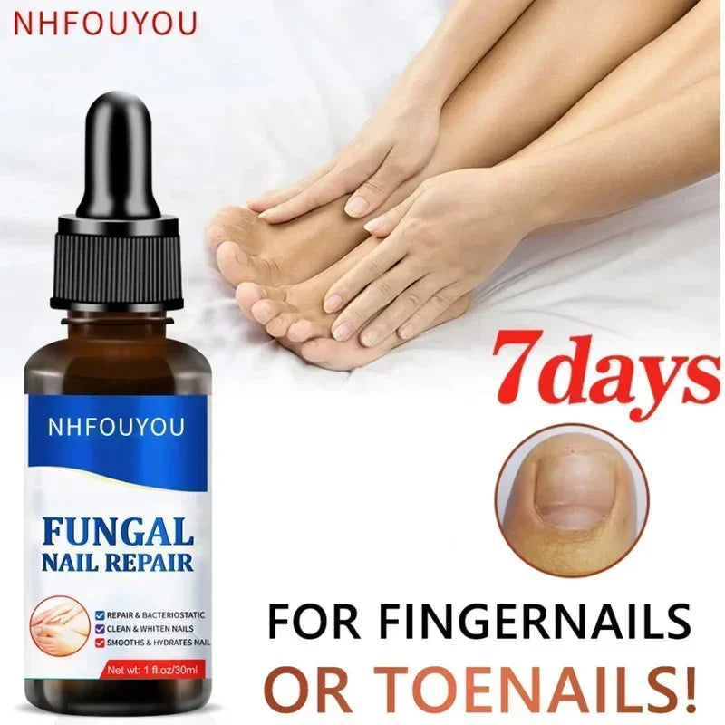 Kerasal Fungal Nail Renewal, Restores Appearance of Discolored or Damaged Nails