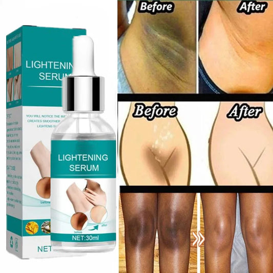 Body Whitening Oil Private Parts Underarm Bleaching Serum Whiten Butt Knee Brighten Inner Thigh Intimate Dark Remove Melanin