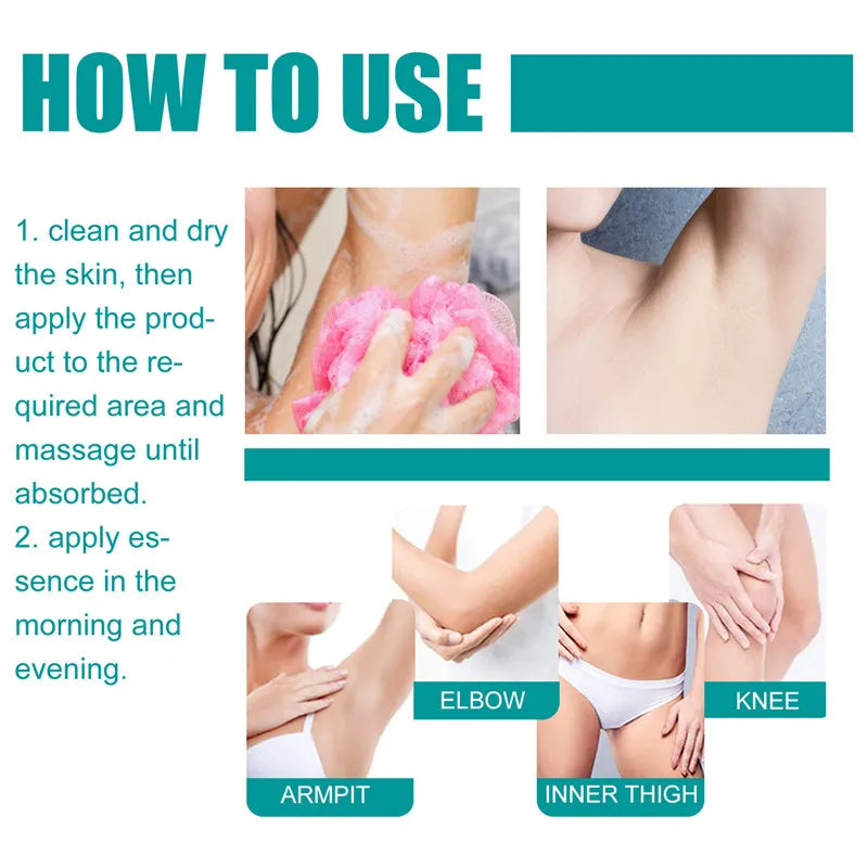 Body Whitening Oil Private Parts Underarm Bleaching Serum Whiten Butt Knee Brighten Inner Thigh Intimate Dark Remove Melanin